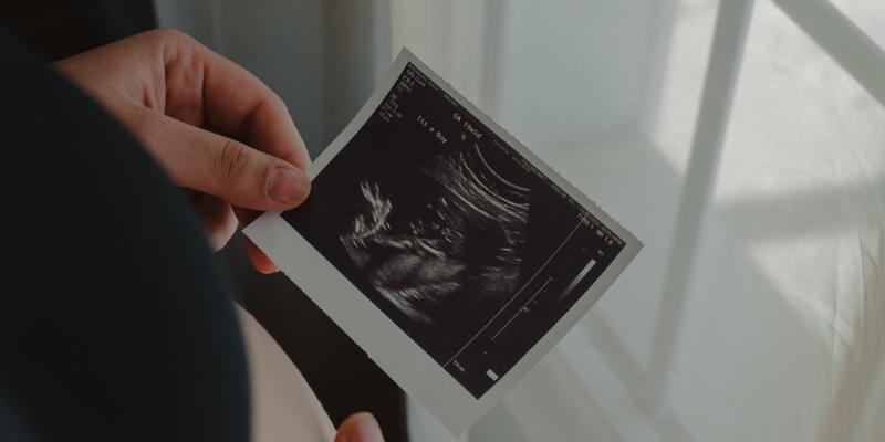 רשלנות רפואית באבחון טרום לידה